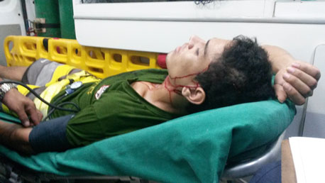 thumb terçadadacalafate