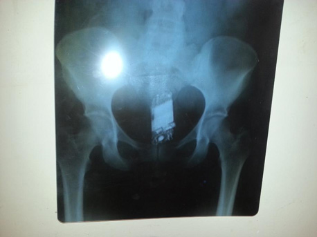thumb radiografica-celular