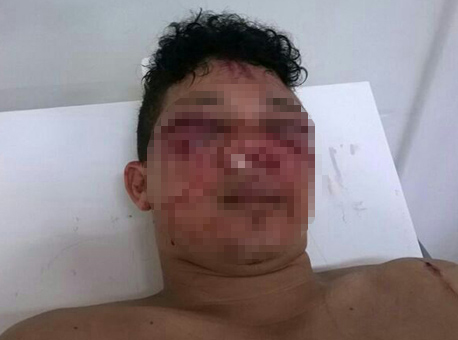 Banner AgressaoEstoq