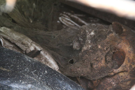 thumb craniobrasileia