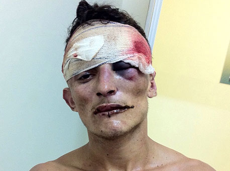 0511-policia-mortenadefla-agazetanet