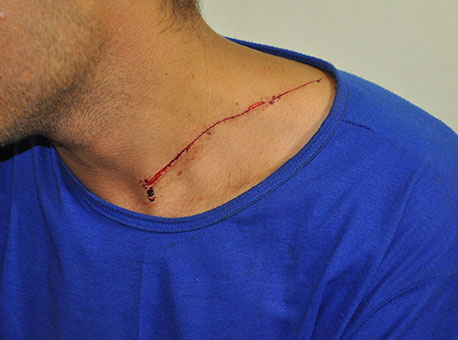 070115-policia-tentativadehomicidio-cleriston