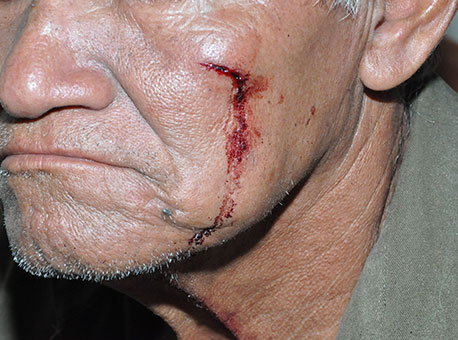 090415-policia-idosoagredido-cleriston