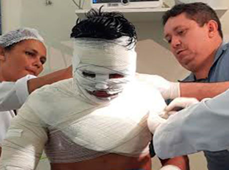 170515-policia-presoqueimado-cedida