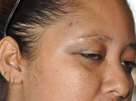 110615-policia-cobradoraagredida-cleriston2