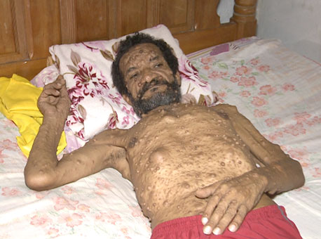 140715-cotidiano-homemdoente-tvgazeta