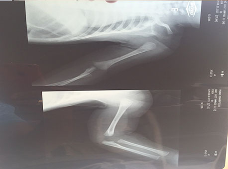 161015-cotidiano-crianca-cedida