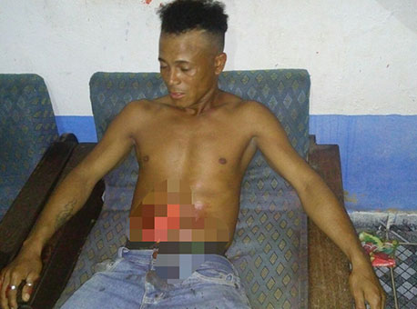 241215-policia-tentativadehomicidio-cedida