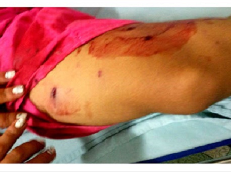 060116-policia-tentdehomicidio