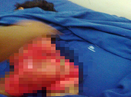 080116-policia-criancaqueimada-dirleynascimento