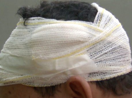 180116-policia-assalto-tvgazeta