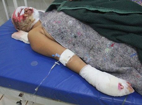 020516-policia-mulheragredida-oaltoacre