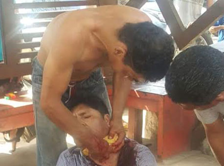 050516-policia-esfaqueadonopescoco-cedida