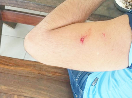 200616-policia-tentativadefugamenores-cleriston2