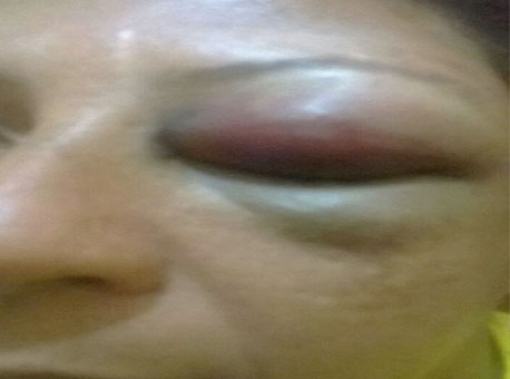 130716-policia-agressao-cedida