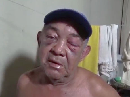 180716-policia-idosoagredido-tvgazeta