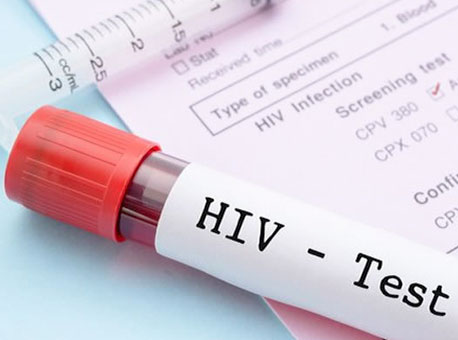 270916-cotidiano-hiv-cedida