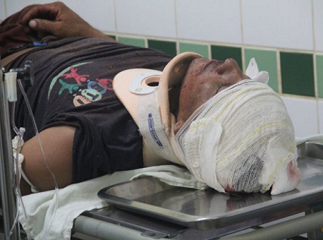 290916-cotidiano-acidente-epitaciolandia