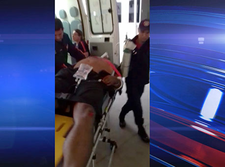 290916-policia-agentebaleado-cedida