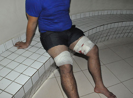 211116-policia-motoristabaleado-cleriston