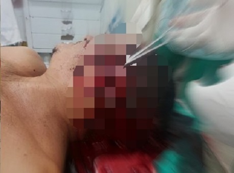 090218-policia-tiro-na-orelha