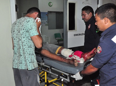 160318-policia-baleado-belo-jardim