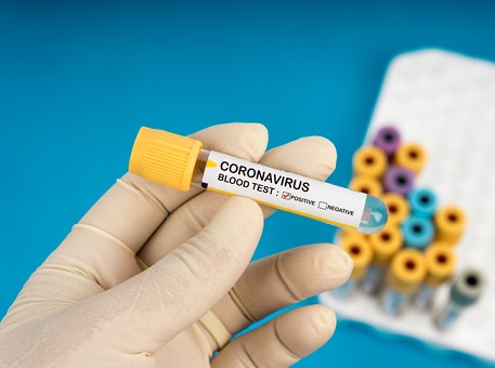 11-04-20 coronavirus-3