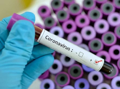 12-04-20 coronavírus