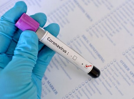 13042020-teste-positivo