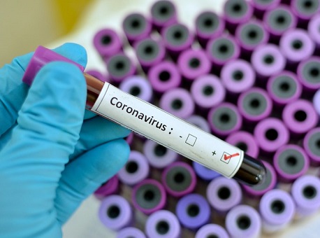 20-04-20 coronavirus