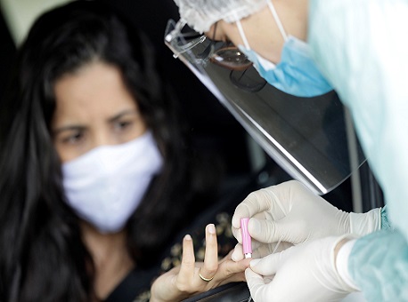 230420-coronavirus-10-mortes-acre