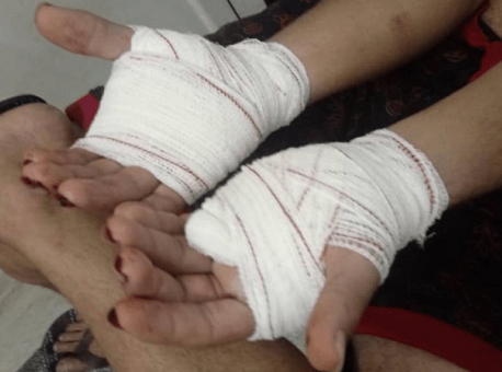 28-04-20 baleado czs