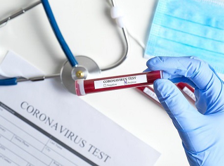 17-11-2020 sesacre-já-identificou-15-possíveis-casos-de-reinfecção-por-coronavírus-no-acre