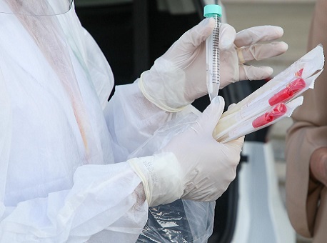 07-12-20-casos-de-covid-acre