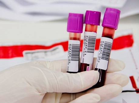 06-03-21 amostras-de-sangue-estragam-em-rio-branco