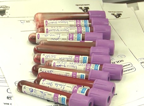 09-04-21-Diminuição malária Acre