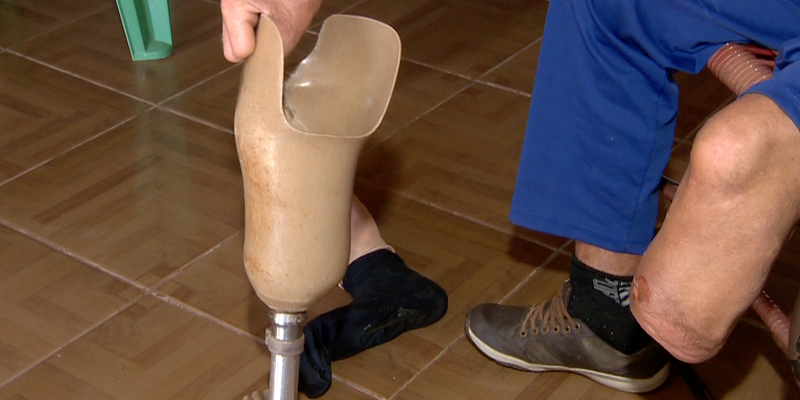 No Juruá, pessoas com hanseníase se tornam transmissoras em potencial