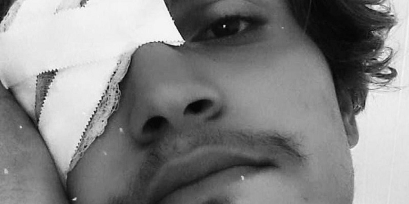 Familiares abrem vakinha para ajudar jovem agredido em maio