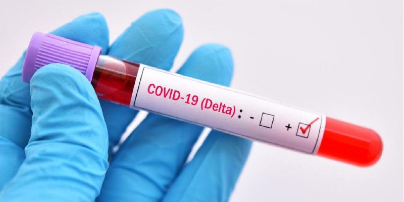 Efeito da variante Delta no Brasil é diferente de outros lugares