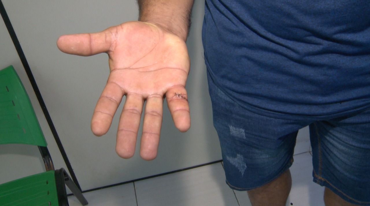 Policial militar agride árbitro após partida de futebol amador