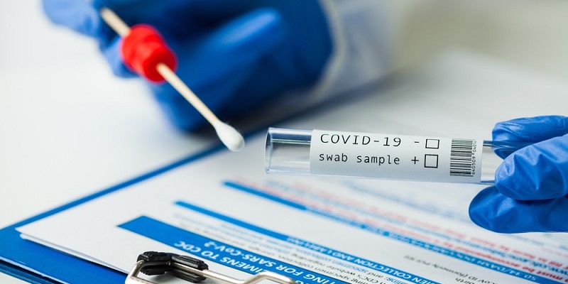 Acre registra queda em ánalise de testes por covid-19