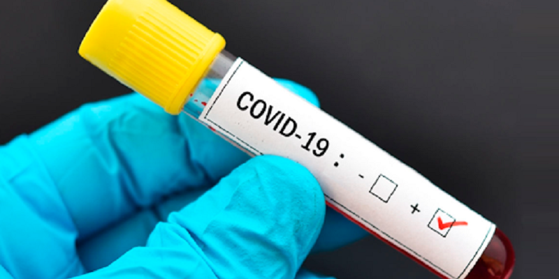 Sesacre registra uma morte por covid-19 nesta terça-feira