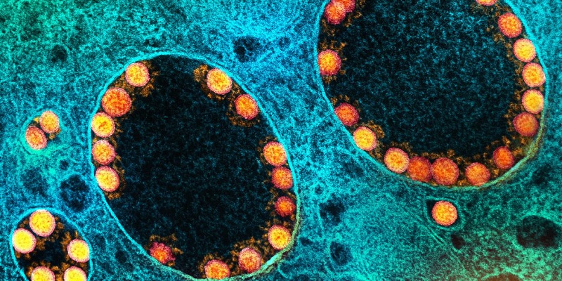 França identifica nova variante do coronavírus com mais de 40 mutações