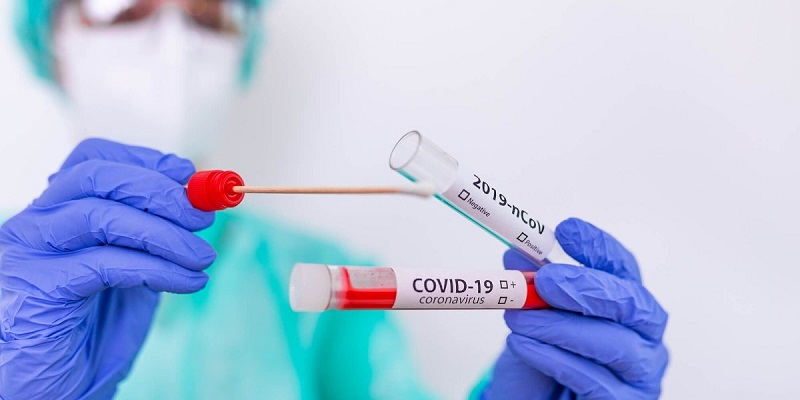 Acre deve receber mais de 60 mil testes para covid-19 nesta segunda-feira