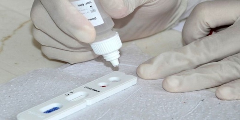 Sindmed alerta que testes para covid-19 estão acabando no Acre