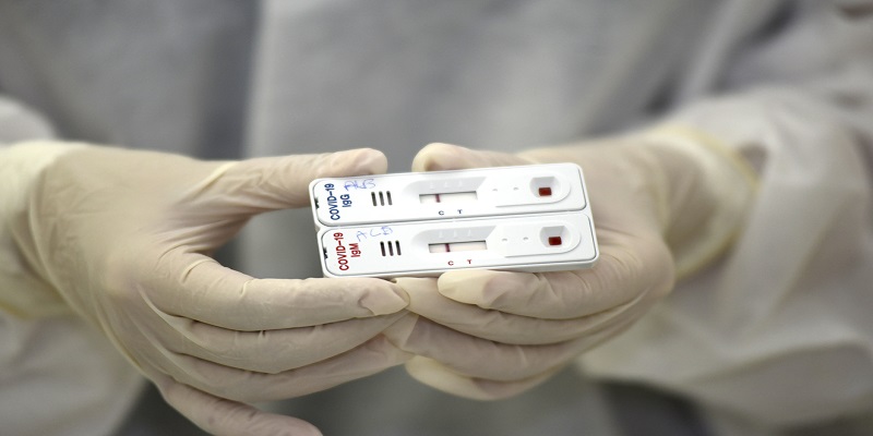 Acre deve receber na próxima semana 60 mil testes rápidos para covid-19