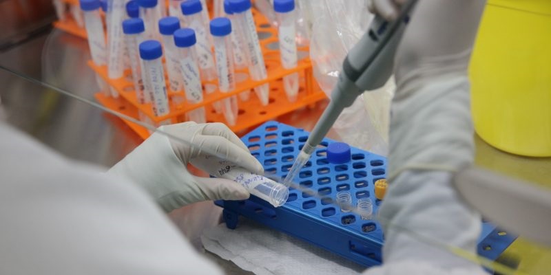 Com 1.171 exames de covid-19 aguardando resultados, Lacen recebe mais de 9,9 mil reagentes nesta terça-feira