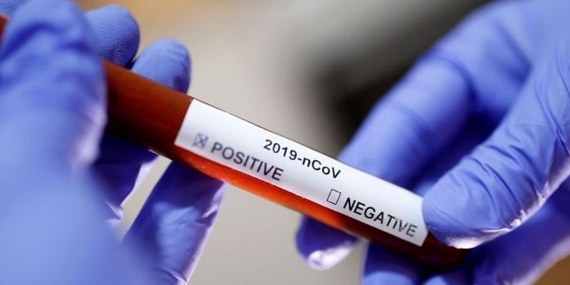 Acre registra apenas um caso de covid-19 nesta segunda-feira