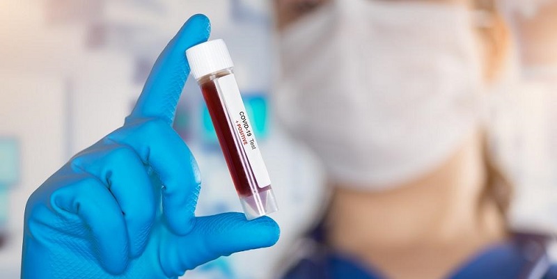 Acre registra 31 casos de covid-19 e nenhum óbito neste domingo