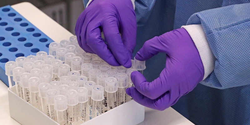 Acre registra três mortes e 156 casos por covid-19 em 24 horas